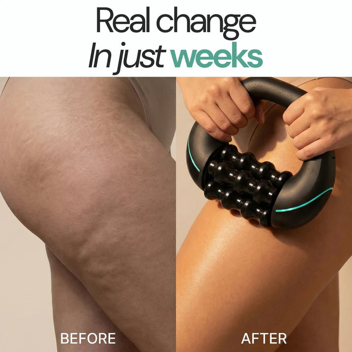 Auresti RollShaper – Anti-Cellulite Massage Roller